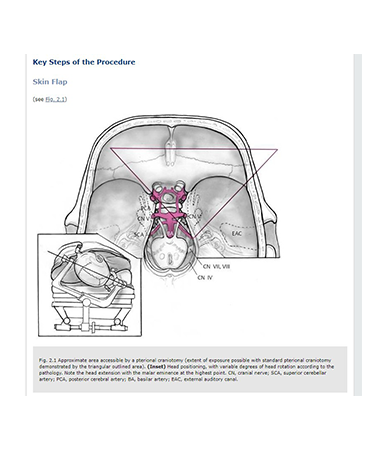 procedures4