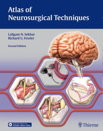 洋書 Osborn´s Brain 第2版 脳外科 解剖学 脳腫瘍 放射線学-