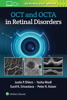 OCT & Octa in Retinal Disorders: 洋書／南江堂