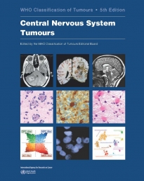 WHO Classification of Tumours of the Central Nervous System (WHO Health Organization Classification of Tumours) [ペーパーバック] International Agency for Research on Cancer、 Louis，David N.、 Ohgaki，Hiroko、 Wi