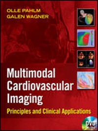 Multimodal Cardiovascular Imaging- Principles & Clinical Applications(With DVD-ROM)