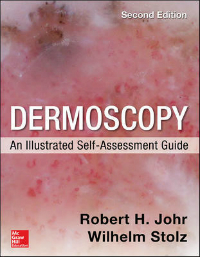 Dermoscopy, 2nd ed.- Illustrated Self-Assessment Guide