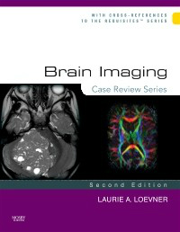 Brain Imaging, 2nd ed.- Case Review Series