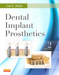 Dental Implant Prosthetics, 2nd ed.