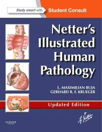 Netter's Illustrated Human Pathology, Updated ed.,With Student Consult Access
