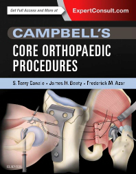 Campbell's Core Orthopaedic Procedures: 洋書／南江堂