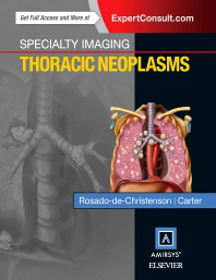 Thoracic Neoplasms(Specialty Imaging Series)