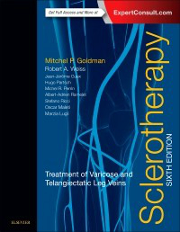 Sclerotherapy, 6th ed.- Treatment of Varicose & Telangiectatic Leg Veins