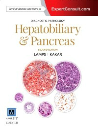 Diagnostic Pathology: Hepatobiliary & Pancreas, 2nd ed.