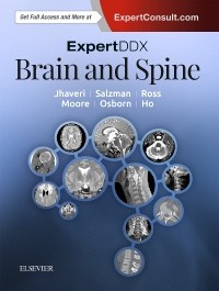 Expert Differential Diagnoses: Brain & Spine, 2nd ed.