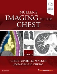 Muller's Imaging of the Chest, 2nd ed.