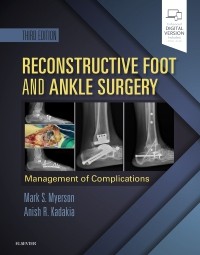 Reconstructive Foot & Ankle Surgery, 3rd ed.,- Management of Complications