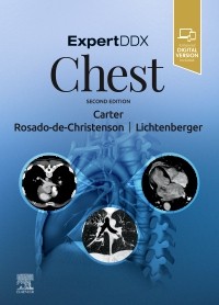 Expert Differential Diagnoses: Chest, 2nd ed.