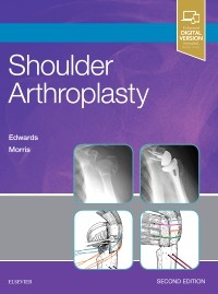 Shoulder Arthroplasty, 2nd ed.