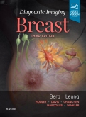Diagnostic Imaging: Breast, 3rd ed.