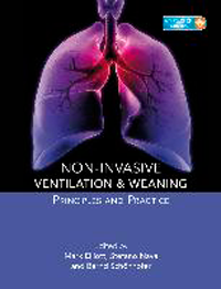 Non-Invasive Ventilation & Weaning- Principles & Practice