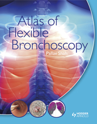 Atlas of Flexible Bronchoscopy