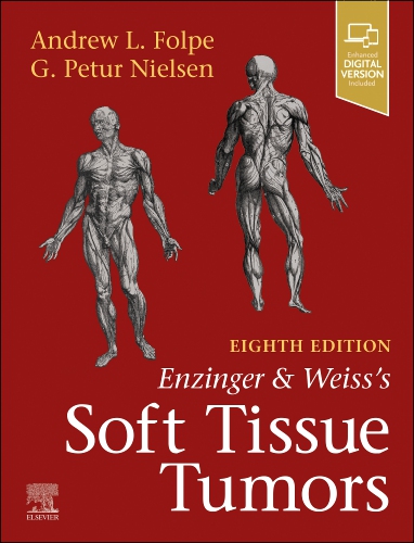 Enzinger & Weiss's Soft Tissue Tumors, 8th ed.