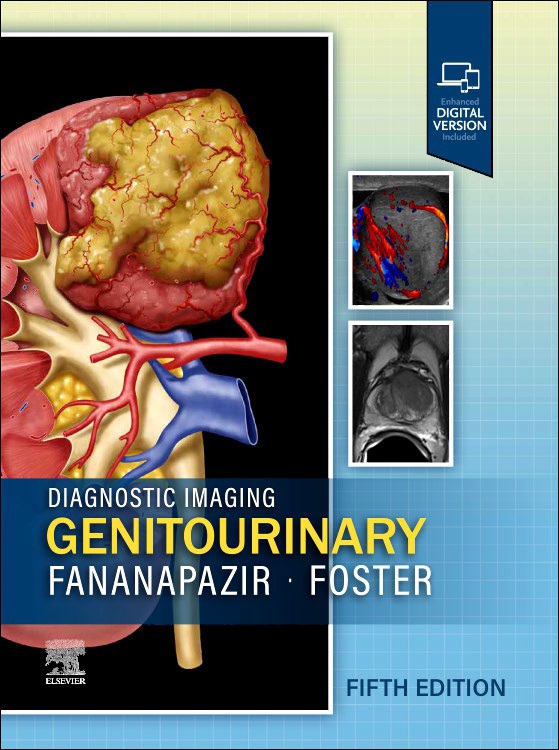 Diagnostic Imaging: Genitourinary, 5th ed.