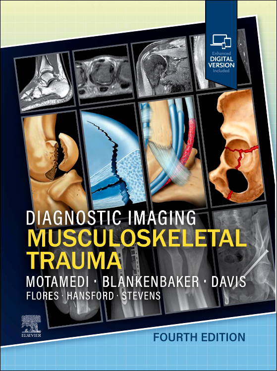 Diagnostic Imaging: Musculoskeletal Trauma, 4th ed.