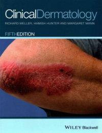 Clinical Dermatology, 5th ed.