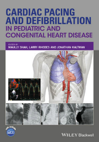 Cardiac Pacing & Defibrillation in Pediatric &Congenital Heart Disease