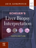 Scheuer's Liver Biopsy Interpretation, 10th ed.