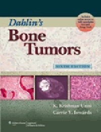 Dahlin's Bone Tumors, 6th ed.- General Aspects & Data on 10,165 Cases