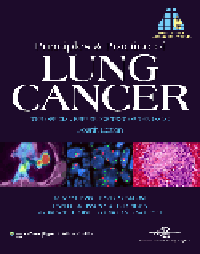Principles & Practice of Lung Cancer, 4th ed.- Official Reference Text of IASLC