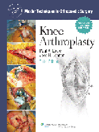 Knee Arthroplasty, 3rd ed.(Master Techniques in Orthopaedic Surgery Series)