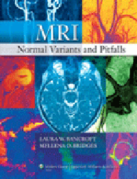 MRI Normal Variants & Pitfall