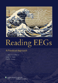 Reading EEGs- Practical Approach