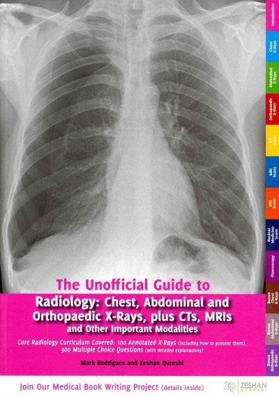 Unofficial Guide to Radiology- Chest, Abdominal & Orthopaedic X-Rays, Plus Cts, Mris& Other Important Modalities