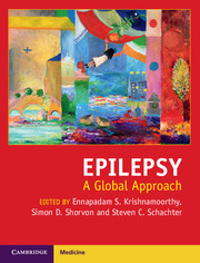 Epilepsy- A Global Approach
