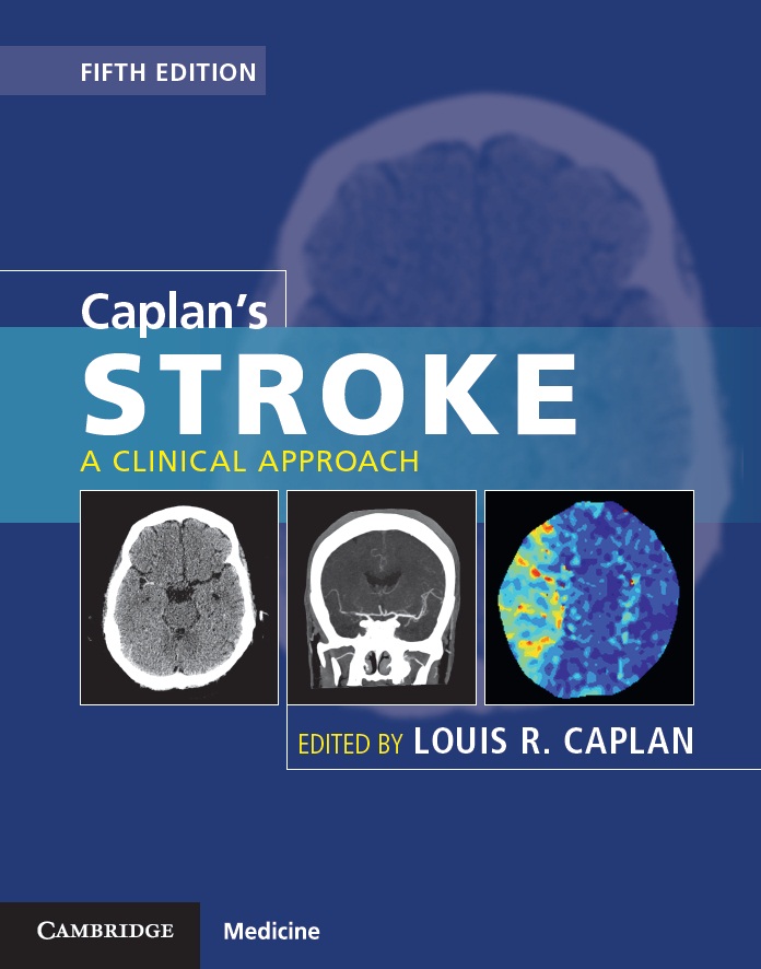 Caplan's Stroke, 5th ed.- A Clinical Approach