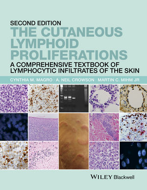Cutaneous Lymphoid Proliferations, 2nd ed.- A Comprehensive Textbook of Lymphocytic InfiltratesOf the Skin,