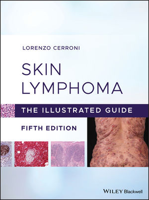 Skin Lymphoma, 5th ed.- Illustrated Guide