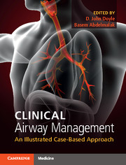 Clinical Airway Management- An Illustrated Case-Based Approach