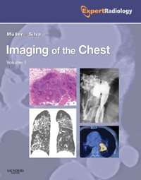 Imaging of the Chest, in 2 vols.(Expert Radiology Series)