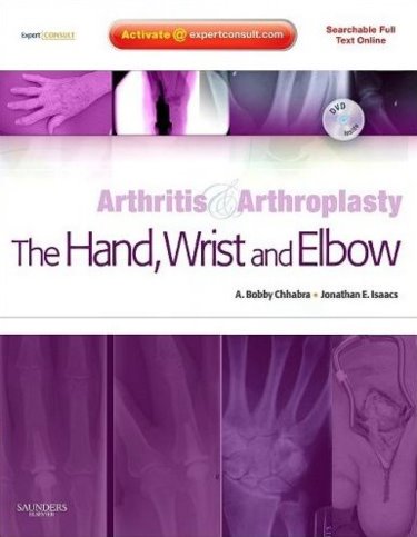 Arthritis & Arthroplasty: Hand, Wrist & Elbow,With DVD