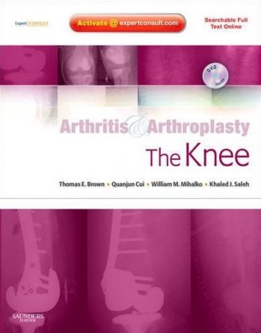 Arthritis & Arthroplasty: Knee, with DVD