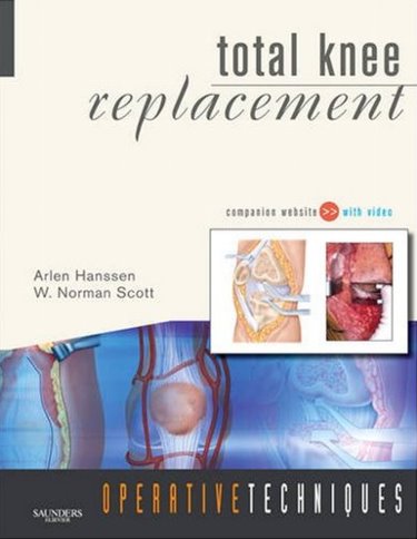 Operative Techniques: Total Knee ReplacementWith Website & DVD