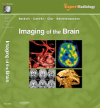 Imaging of the Brain(Expert Radiology Series)