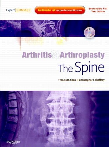 Arthritis & Arthroplasty: Spine, with DVD