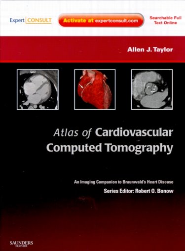 Atlas of Cardiovascular Computed Tomography with ExpertWith Expert Consult- Imaging Companion to Braunwald's Heart Disease