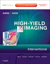 High-Yield Imaging: Interventional(High-Yield in Radiology Series)