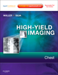 High-Yield Imaging: Chest(High-Yield in Radiology Series)