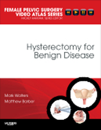 Hysterectomy for Benign Disease- Female Pelvic Surgery Video Atlas Series(With DVD-ROM)