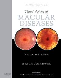 Gass' Atlas of Macular Diseases, 5th ed., in 2 vols.(Stereoscopic Viewer Included)With Expert Consult Premium ed.