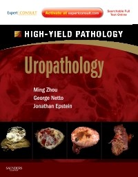 Uropathology(High-Yield Pathology Series)